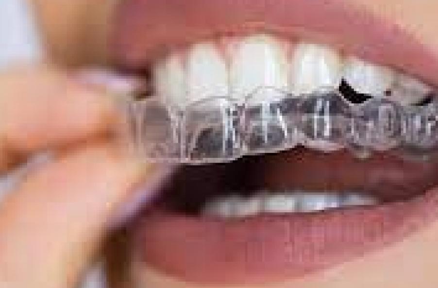 Steeds meer volwassenen willen aligners, orthodontist waarschuwt...